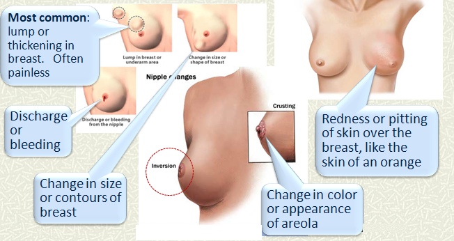 Lady Breast Surgeon in Pune
